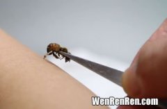 蜜蜂针人后为什么会死,为什么蜜蜂蛰人后会死?